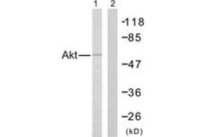 Western blot analysis of extracts from Jurkat cells, treated with H2O2, using Akt (Ab-308) Antibody. (AKT1 antibody  (AA 276-325))