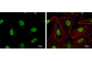 Immunofluorescence (IF) image for anti-X-Ray Repair Complementing Defective Repair in Chinese Hamster Cells 6 (XRCC6) (C-Term) antibody (ABIN2855186)