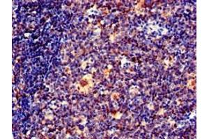 Immunohistochemistry of paraffin-embedded human tonsil tissue using ABIN7151428 at dilution of 1:100 (EFHD2 antibody  (AA 2-240))