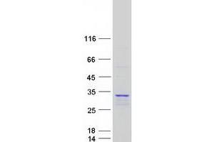 Validation with Western Blot (PSMA6 Protein (Myc-DYKDDDDK Tag))