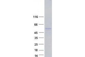 Validation with Western Blot (PDE9A Protein (Transcript Variant 9) (Myc-DYKDDDDK Tag))