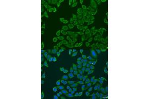 Immunofluorescence analysis of U2OS cells using RPL36 antibody. (RPL36 antibody  (AA 1-105))