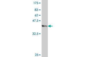 Western Blot detection against Immunogen (37. (HHEX antibody  (AA 133-237))