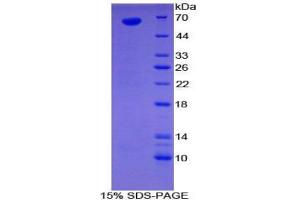 SDS-PAGE analysis of Human Sulfatase 1 Protein.