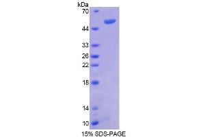SDS-PAGE (SDS) image for Regulator of G-Protein Signaling 1 (RGS1) (AA 1-209) protein (His tag,GST tag) (ABIN6237852) (RGS1 Protein (AA 1-209) (His tag,GST tag))