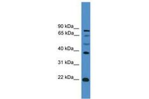Image no. 1 for anti-Achaete-Scute Complex Homolog 2 (ASCL2) (AA 121-170) antibody (ABIN6745359) (ASCL2 antibody  (AA 121-170))