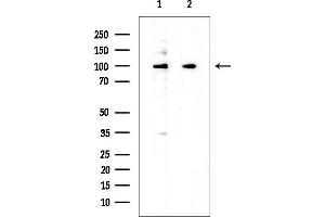 anti-Zinc Finger Protein 91 (ZFP91) antibody