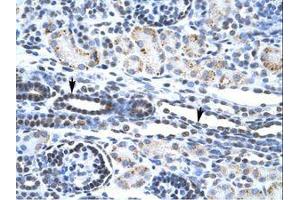 Image no. 2 for anti-V-Ets erythroblastosis Virus E26 Oncogene Homolog 1 (Avian) (ETS1) (AA 52-101) antibody (ABIN202532) (ETS1 antibody  (AA 52-101))
