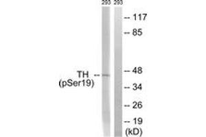 Western blot analysis of extracts from 293 cells treated with Insulin 0. (Tyrosine Hydroxylase antibody  (pSer18))