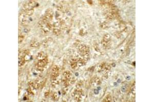 Immunohistochemical staining of mouse brain cells with ATP2C1 polyclonal antibody  at 5 ug/mL.