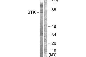 Western blot analysis of extracts from Hela cells, using BTK (Ab-222) antibody (#B0054, Line 1 and 2). (BTK antibody  (Tyr222))