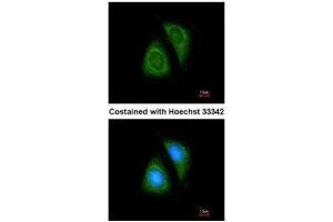 ICC/IF Image Immunofluorescence analysis of methanol-fixed HeLa, using SHP1, antibody at 1:200 dilution. (SHP1 antibody  (Center))