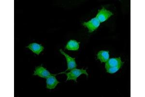IF analysis of Beta 2 Microglobulin/B2m using anti-Beta 2 Microglobulin/B2m antibody (ABIN7600594).