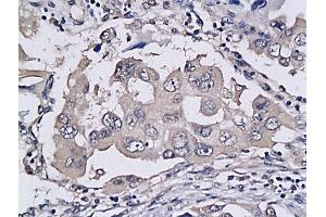 Immunohistochemistry (IHC) image for anti-Tumor Necrosis Factor Receptor Superfamily, Member 10b (TNFRSF10B) (AA 301-381) antibody (ABIN733118)