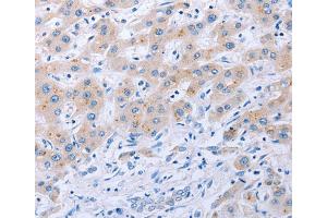 Immunohistochemistry (IHC) image for anti-Fibroblast Growth Factor 4 (FGF4) antibody (ABIN2425618) (FGF4 antibody)