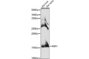 Western blot analysis of extracts of various cell lines, using RBP1 antibody (ABIN6129597, ABIN6146795, ABIN6146796 and ABIN6214136) at 1:1000 dilution.