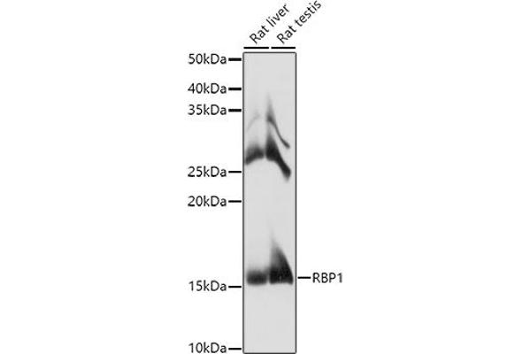 RBP1 antibody  (AA 63-197)