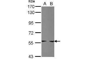 WB Image Sample (30 ug of whole cell lysate) A: HepG2 B: HCT116 7. (PPAT antibody)