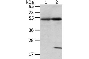 Gel: 8 % SDS-PAGE, Lysate: 80 μg, Lane 1-2: Human lung cancer and placenta tissue, Primary antibody: ABIN7192580(SNTA1 Antibody) at dilution 1/200 dilution, Secondary antibody: Goat anti rabbit IgG at 1/8000 dilution, Exposure time: 1 minute (SNTA1 antibody)