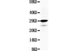 Anti-Calretinin antibody, Western blotting WB: HELA Cell Lysate (Calretinin antibody  (N-Term))