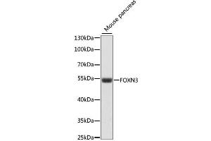 Western blot analysis of extracts of mouse pancreas, using FOXN3 antibody (ABIN6290407) at 1:1000 dilution. (FOXN3 antibody)