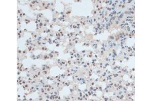 Immunohistochemistry of paraffin-embedded Mouse lung using ZNF433 Polyclonal Antibody at dilution of 1:100 (40x lens).