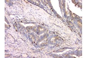 IHC analysis of Cystatin C/CST3 using anti-Cystatin C/CST3 antibody (ABIN6719299). (CST3 antibody  (AA 31-146))