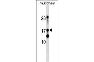 Western blot analysis in mouse kidney tissue lysates (35ug/lane). (DR1 antibody  (AA 83-112))