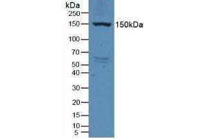 Detection of VEGFR2 in Rat Serum using Polyclonal Antibody to Vascular Endothelial Growth Factor Receptor 2 (VEGFR2) (VEGFR2/CD309 antibody  (AA 46-320))