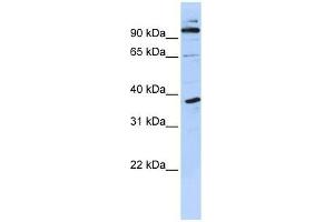 PHF11 antibody used at 0. (PHF11 antibody  (N-Term))