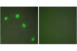 Immunofluorescence (IF) image for anti-X-Ray Repair Complementing Defective Repair in Chinese Hamster Cells 6 (XRCC6) (AA 560-609) antibody (ABIN1533333)