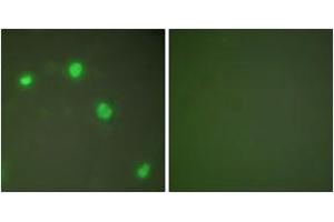 Immunofluorescence analysis of COS7 cells, using Ku70 Antibody. (XRCC6 antibody  (AA 560-609))