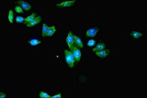 Immunofluorescent analysis of HepG2 cells using ABIN7157306 at dilution of 1:100 and Alexa Fluor 488-congugated AffiniPure Goat Anti-Rabbit IgG(H+L) (KLHDC5 antibody  (AA 1-410))