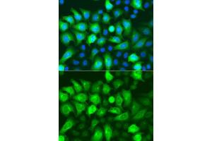 Immunofluorescence analysis of A549 cells using RRM2 antibody. (RRM2 antibody  (AA 1-389))