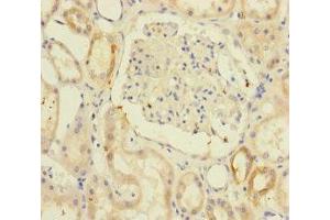 Immunohistochemistry of paraffin-embedded human kidney tissue using ABIN7171203 at dilution of 1:100 (RIC8A antibody  (AA 362-531))