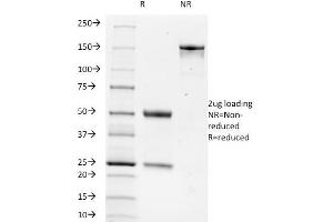 SDS-PAGE Analysis Purified TRIM29 Monoclonal Antibody (TRIM29/1042). (TRIM29 antibody  (AA 1-200))