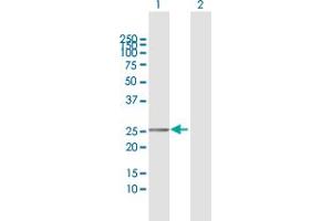 Western Blot analysis of TMEM177 expression in transfected 293T cell line by TMEM177 MaxPab polyclonal antibody. (TMEM177 antibody  (AA 31-311))