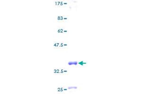 CLPS Protein (AA 1-112) (GST tag)