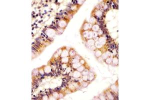 (ABIN655484 and ABIN2845005) staining RSBN1 in human colon tissue sections by Immunohistochemistry (IHC-P - paraformaldehyde-fixed, paraffin-embedded sections).