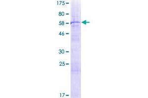 Poly (ADP-Ribose) Polymerase Family, Member 11 (PARP11) (AA 1-331) protein (GST tag)