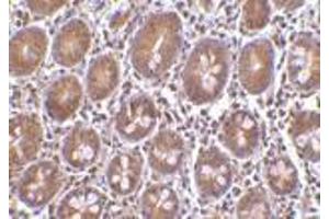 Immunohistochemistry of Bit1 in human small intestine tissue with Bit1 antibody at 10 μg/ml. (PTRH2 antibody  (Middle Region))