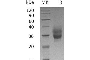 Western Blotting (WB) image for Tumor Necrosis Factor Receptor Superfamily, Member 9 (TNFRSF9) protein (His tag) (ABIN7320978)
