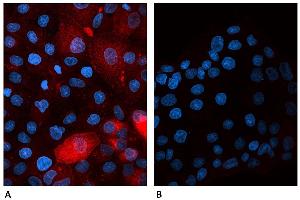 Confocal microscopy of human β2-microglobulin-transfected canine cells labeled A) with B2M-01 antibody Alexa Fluor® 647 conjugate  and B) with Alexa Fluor® 647 conjugated Mouse IgG2a Isotype Control (A6-458-C100). (beta-2 Microglobulin antibody)