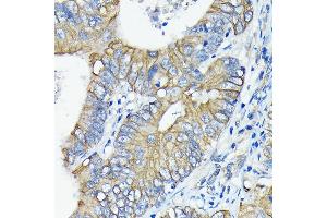 Immunohistochemistry (IHC) image for anti-Tumor Necrosis Factor Receptor Superfamily, Member 10b (TNFRSF10B) antibody (ABIN7271062)