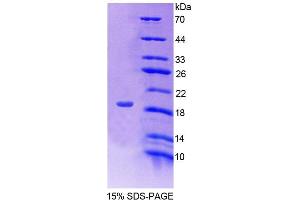 SDS-PAGE analysis of Human FKBP2 Protein. (FKBP2 Protein)