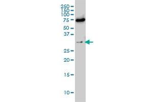 EXOSC8 monoclonal antibody (M01), clone 1G5 Western Blot analysis of EXOSC8 expression in Hela S3 NE . (EXOSC8 antibody  (AA 1-276))