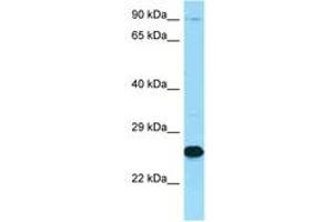 Image no. 1 for anti-Membrane Metallo-Endopeptidase (MME) (C-Term) antibody (ABIN6748399) (MME antibody  (C-Term))
