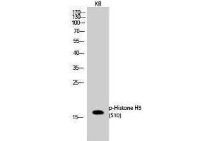 Western Blotting (WB) image for anti-Histone 3 (H3) (pSer10) antibody (ABIN3182028) (Histone 3 antibody  (pSer10))