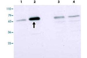 Western blot using SMAD2 polyclonal antibody  to detect over-expressed SMAD2 in COS cells (arrow). (SMAD2 antibody  (Internal Region))
