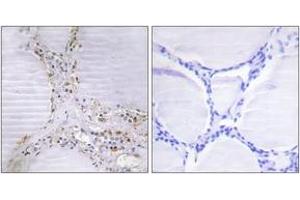 Immunohistochemistry analysis of paraffin-embedded human thyroid gland tissue, using BMX Antibody. (BMX antibody  (AA 11-60))
